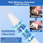 Dog Teeth Cleaning Kit,Dogs Tooth Brushing Kit with Light,3 Modes Doggie Toothbrush (Cloud White)