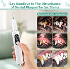 Dog Plaque Remover for Teeth, Pet Ultrasonic Tooth Cleaner Kit, 5 Adjustable Modes Dog Teeth Cleaning Kit with LED Light, Dental Tools, Tartar and Stain Remover for Dogs and Cats (White)